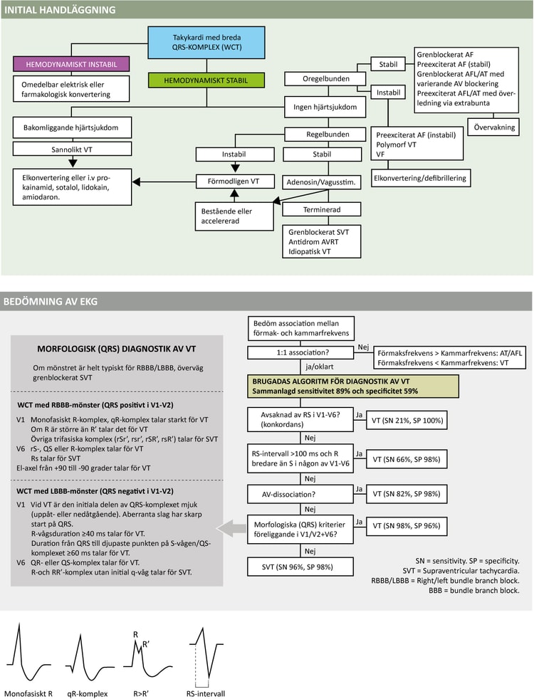Figur 62. Diagnostik och handläggning av takyarytmi med breda QRS-komplex.