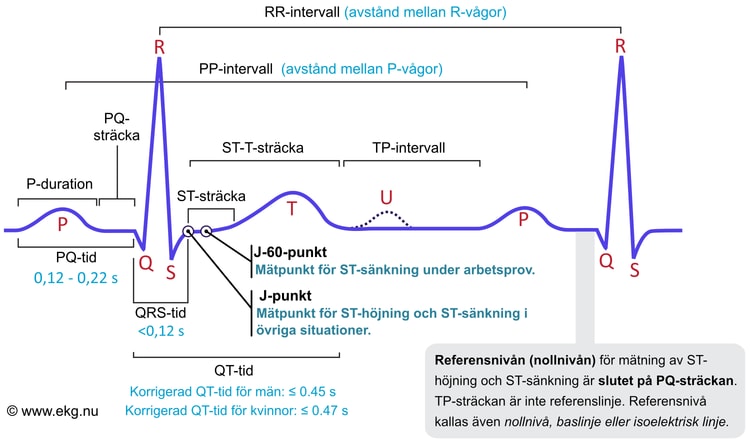 Figur 1. Den klassiska EKG-kurvan. Kammarkomplexet kallas även QRS-komplex, oavsett om det saknas någon av vågorna, Q, R eller S.
