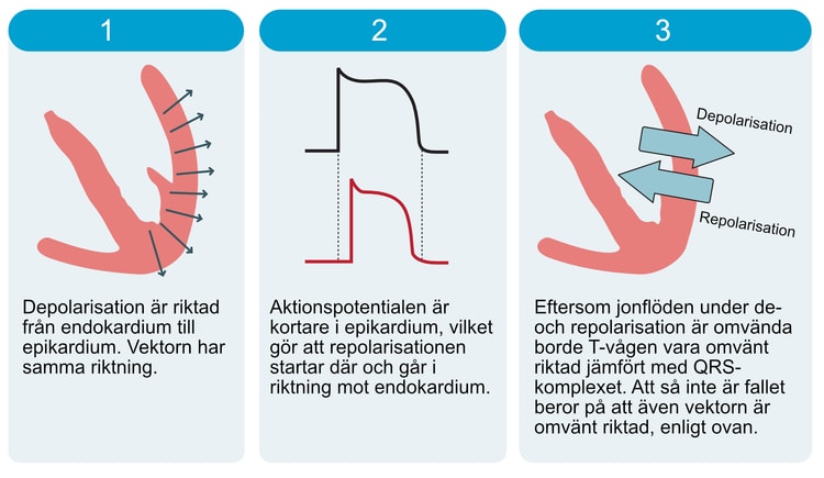 Figur 8. Vektorförhållanden under depolarisation och repolarisation i kamrarna.