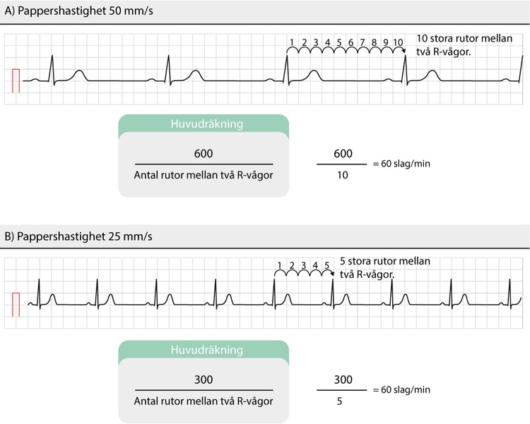 Figur 20. Uppskattning av hjärtfrekvensen utifrån EKG-remsan. Man behöver inte använda R-vågor; det går lika bra att mäta antal stora rutor mellan P-vågor, T-vågor eller någon annan struktur som återkommer regelbundet och som ger en enkel beräkning.