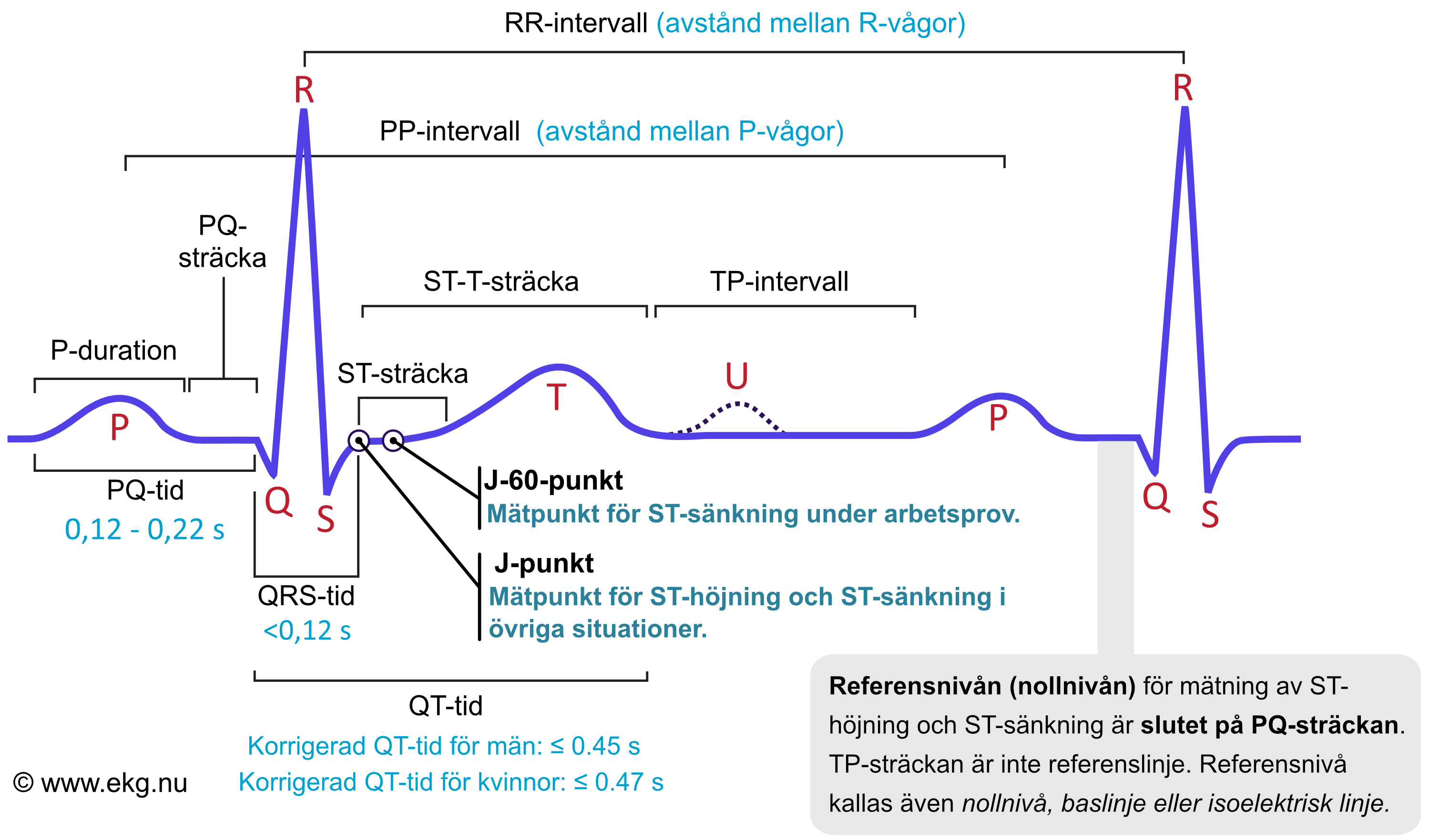 Den klassiska EKG-kurvan med P-våg, PQ-tid, QRS-komplex, J-punkt, ST-sträcka, T-våg och QT-tid utmärkta.