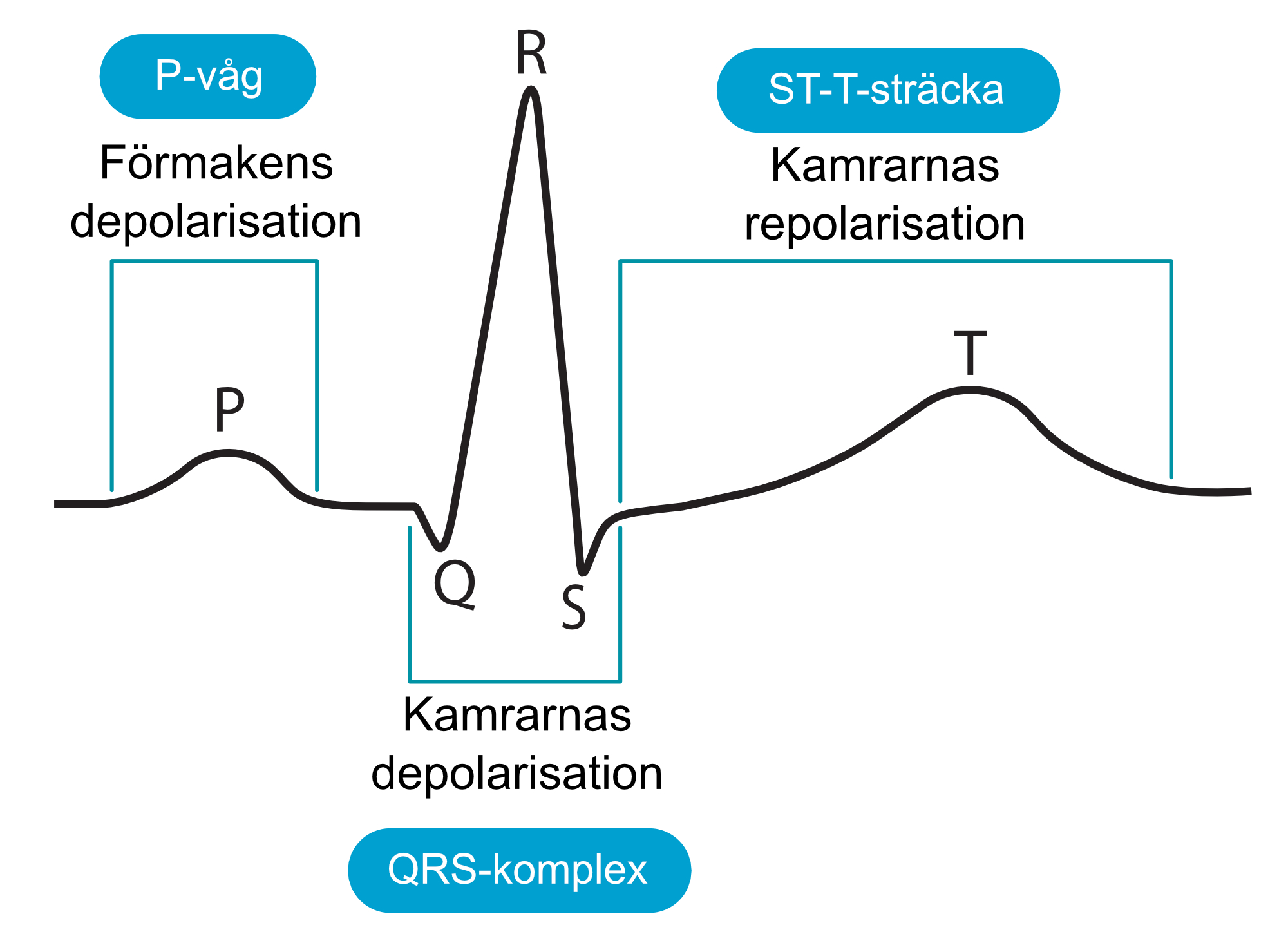 Figur 4. Den klassiska EKG-kurvan och de händelser som avspeglas. På denna registrering ses ett kammarkomplex som består av Q-, R- och S-våg (men en eller flera av dessa kan saknas under normala förhållanden).