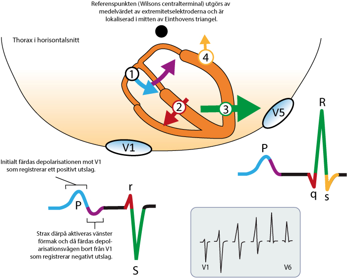 Figur 25. Kammarkomplexets uppkomst. Inspirerad av Electrocardiology, MacFarlane et al, Springer (2010).