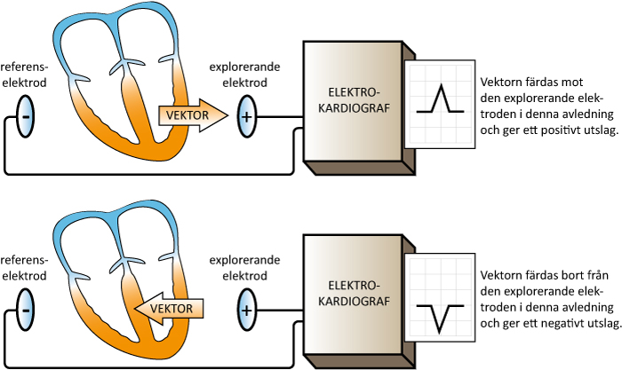 Figur 9. Varje EKG-kurva representerar en avledning. Minst två elektroder ingår i en avledning eftersom det behövs en explorerande elektrod samt en referens.