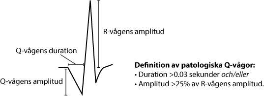 Figur 29. Bedömning av Q-vågor.