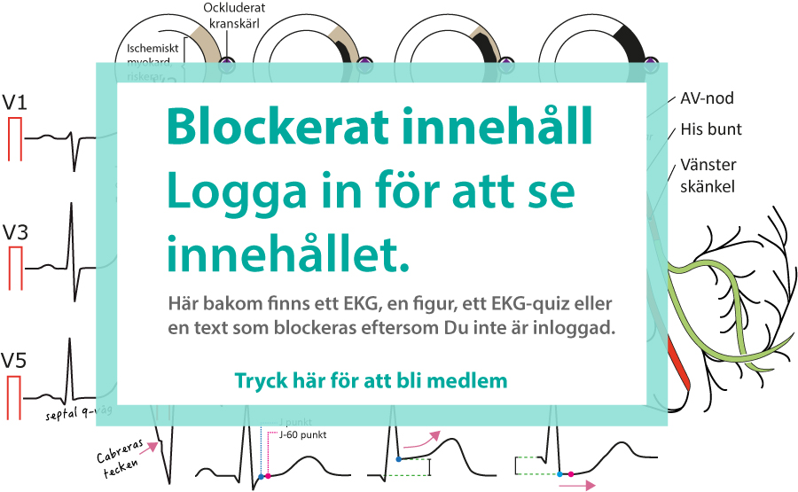 ”Lär
